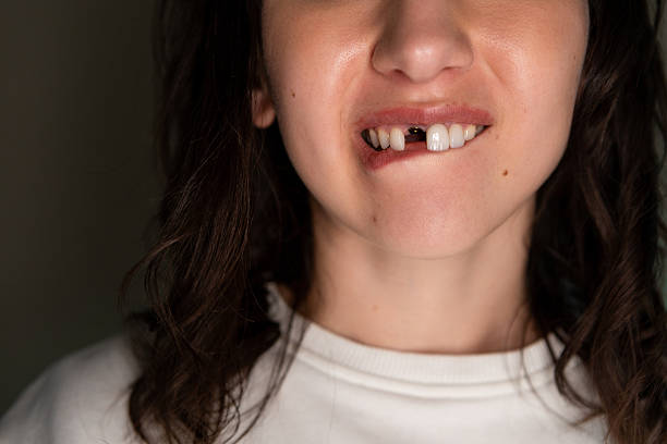 Islamic Meaning Behind a Hole in the Front Tooth in a Dream